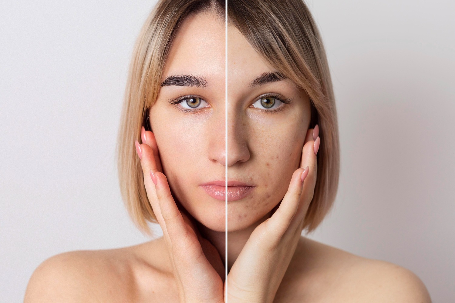 Brightening Treatments