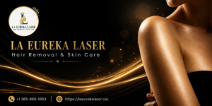 Welcome to La Eureka Laser Hair Removal and Skin Care – Brampton